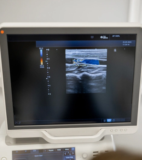 Diagnostic Ultrasound
