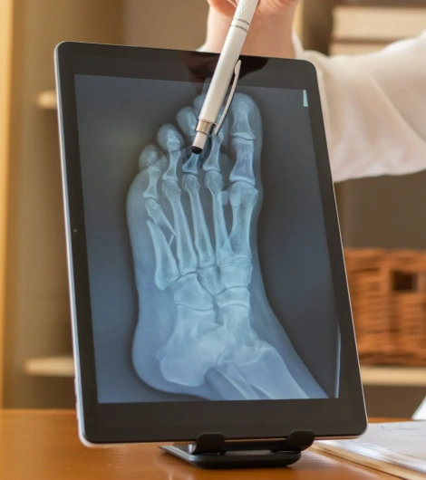 Digital X-Ray