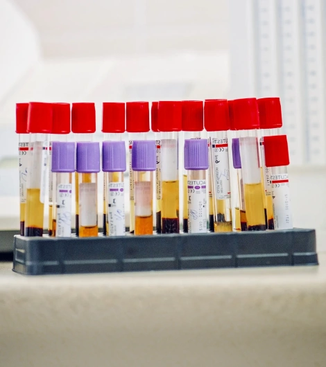 PRP Therapy